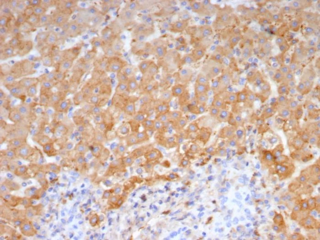 Haptoglobin (HP) Antibody in Immunohistochemistry (Paraffin) (IHC (P))