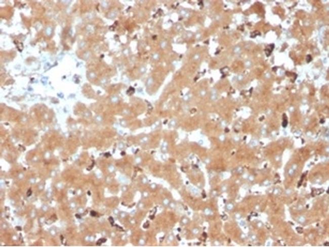 Haptoglobin (HP) Antibody in Immunohistochemistry (Paraffin) (IHC (P))