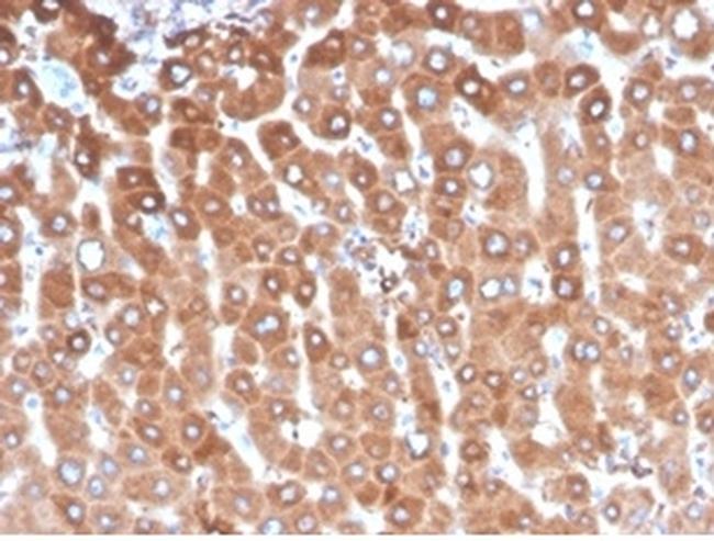 Haptoglobin (HP) Antibody in Immunohistochemistry (Paraffin) (IHC (P))