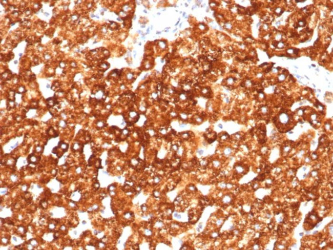 Haptoglobin (HP) Antibody in Immunohistochemistry (Paraffin) (IHC (P))