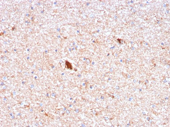 Serum Amyloid P/APCS Antibody in Immunohistochemistry (Paraffin) (IHC (P))