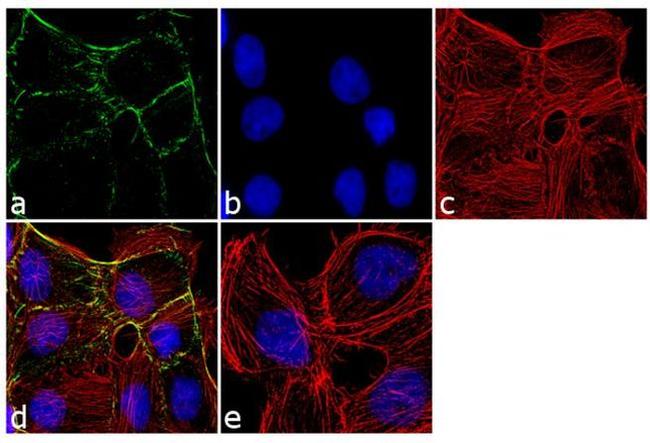 PKP1 Antibody in Immunocytochemistry (ICC/IF)