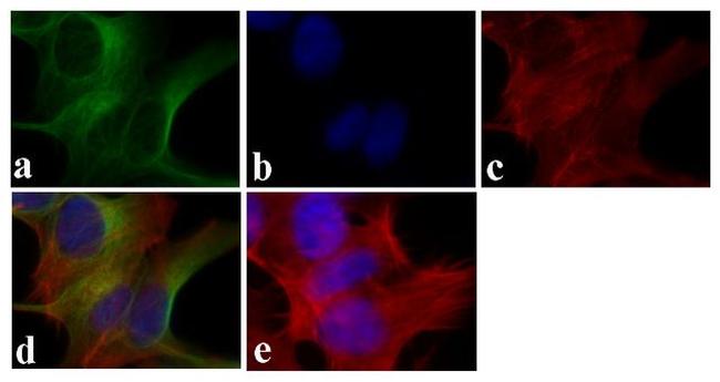 Synuclein alpha/beta Antibody in Immunocytochemistry (ICC/IF)