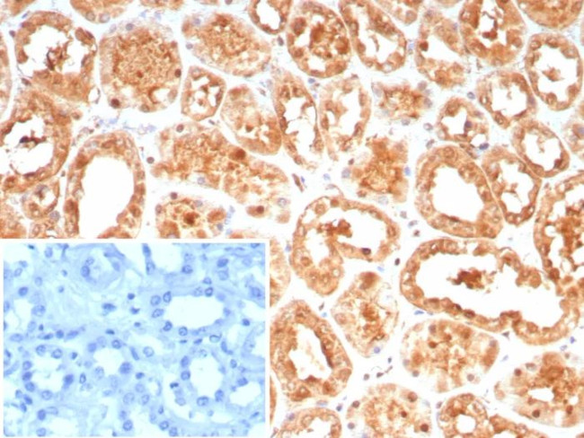 HSP70-1A/HSPA1A Antibody in Immunohistochemistry (Paraffin) (IHC (P))