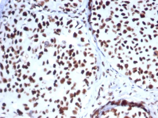 Heat shock 70 kDa protein 1B (HSPA1B) Antibody in Immunohistochemistry (Paraffin) (IHC (P))