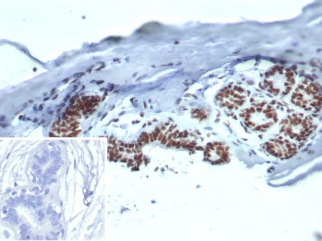 Heat shock 70 kDa protein 1B (HSPA1B) Antibody in Immunohistochemistry (Paraffin) (IHC (P))