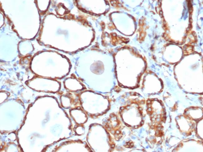 Heat Shock 27kDa Protein 1 Antibody in Immunohistochemistry (Paraffin) (IHC (P))