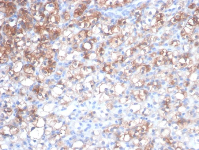 Heat Shock 27kDa Protein 1 Antibody in Immunohistochemistry (Paraffin) (IHC (P))