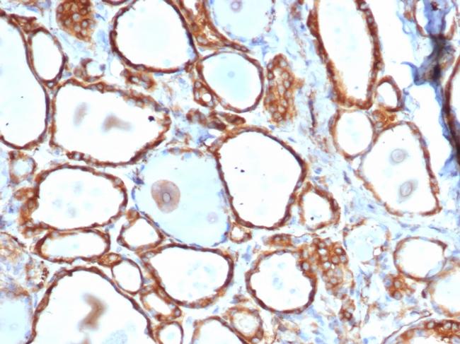 Heat Shock 27kDa Protein 1 Antibody in Immunohistochemistry (Paraffin) (IHC (P))