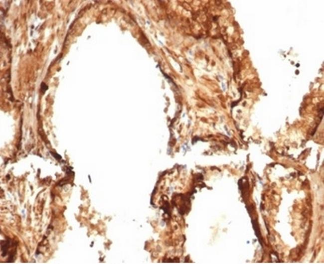 Heat Shock 27kDa Protein 1 Antibody in Immunohistochemistry (Paraffin) (IHC (P))