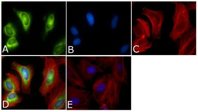 PLK1 Antibody in Immunocytochemistry (ICC/IF)