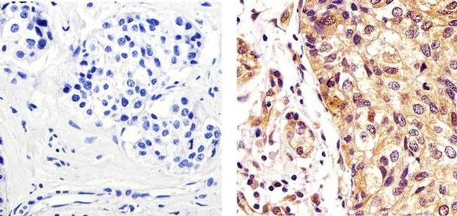 CDK1 Antibody in Immunohistochemistry (Paraffin) (IHC (P))