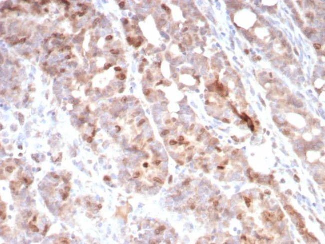 Survivin/BIRC5 Antibody in Immunohistochemistry (Paraffin) (IHC (P))