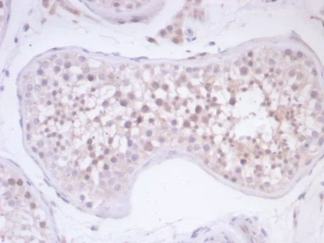 Survivin/BIRC5 Antibody in Immunohistochemistry (Paraffin) (IHC (P))