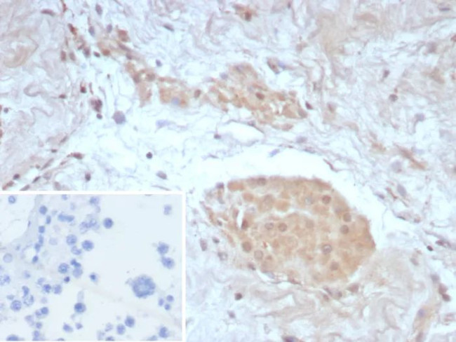 Survivin/BIRC5 Antibody in Immunohistochemistry (Paraffin) (IHC (P))