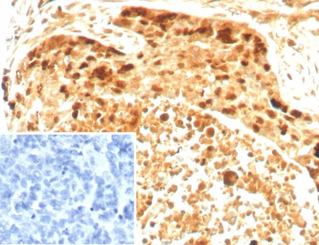 Survivin/BIRC5 Antibody in Immunohistochemistry (Paraffin) (IHC (P))