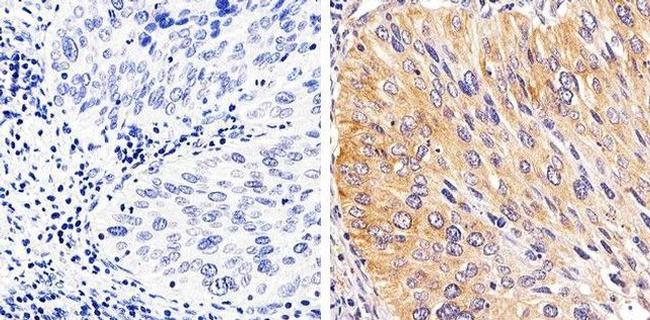 Phospho-STAT1 (Tyr701) Antibody in Immunohistochemistry (Paraffin) (IHC (P))