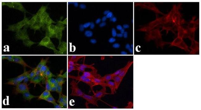 Ankyrin B Antibody in Immunocytochemistry (ICC/IF)