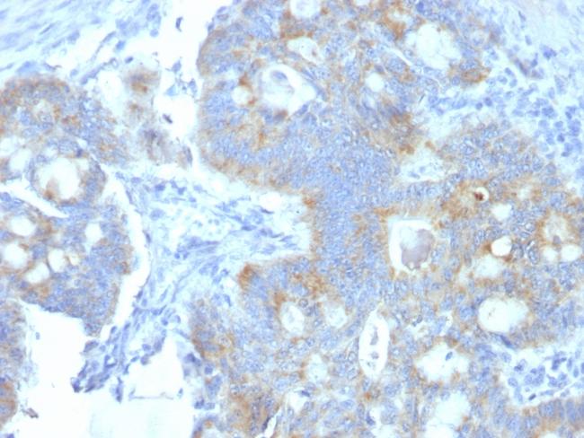 Heparan Sulfate Proteoglycan (Large)/Perlecan Antibody in Immunohistochemistry (Paraffin) (IHC (P))