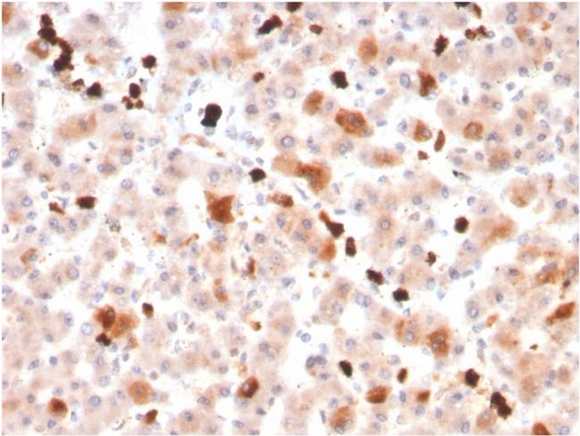 Apolipoprotein A1/APOA1 Antibody in Immunohistochemistry (Paraffin) (IHC (P))