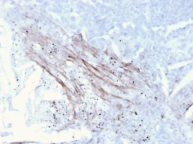 Tenascin C Antibody in Immunohistochemistry (Paraffin) (IHC (P))