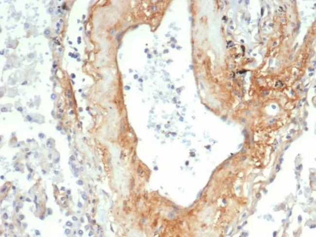 Tenascin C (Stromal Marker for Epithelial Malignancy) Antibody in Immunohistochemistry (Paraffin) (IHC (P))