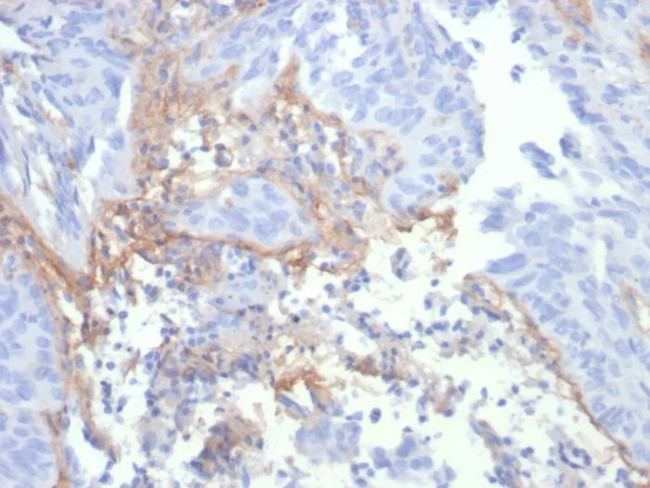 Tenascin C (Stromal Marker for Epithelial Malignancy) Antibody in Immunohistochemistry (Paraffin) (IHC (P))