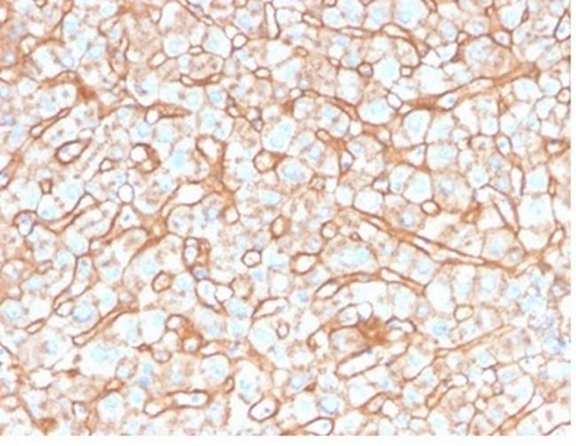 Apolipoprotein B/APOB Antibody in Immunohistochemistry (Paraffin) (IHC (P))