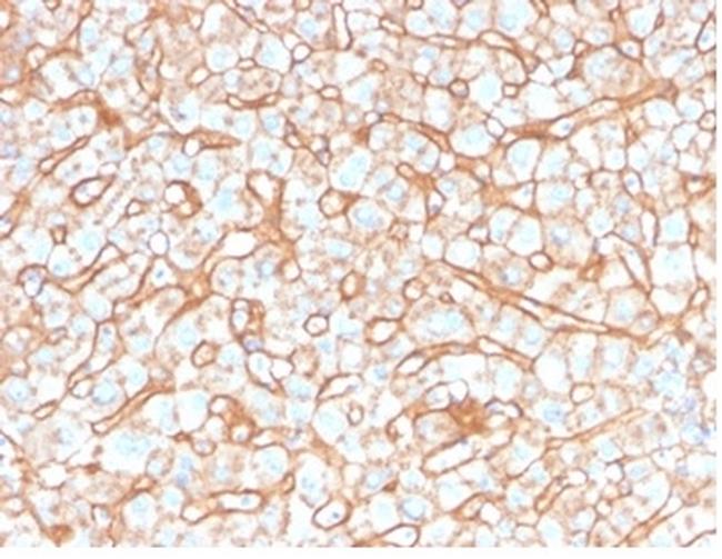 Apolipoprotein B/APOB Antibody in Immunohistochemistry (Paraffin) (IHC (P))