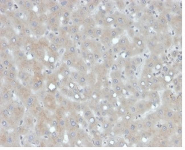 Apolipoprotein B/APOB Antibody in Immunohistochemistry (Paraffin) (IHC (P))