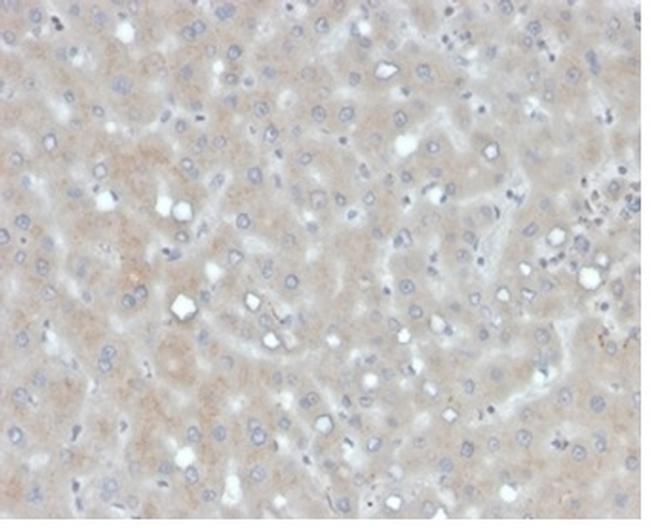 Apolipoprotein B/APOB Antibody in Immunohistochemistry (Paraffin) (IHC (P))