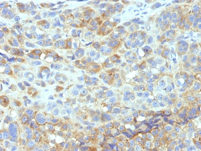 CD54/ICAM-1 Antibody in Immunohistochemistry (Paraffin) (IHC (P))