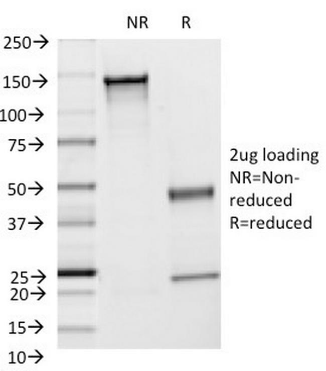 CD54/ICAM-1 Antibody in SDS-PAGE (SDS-PAGE)