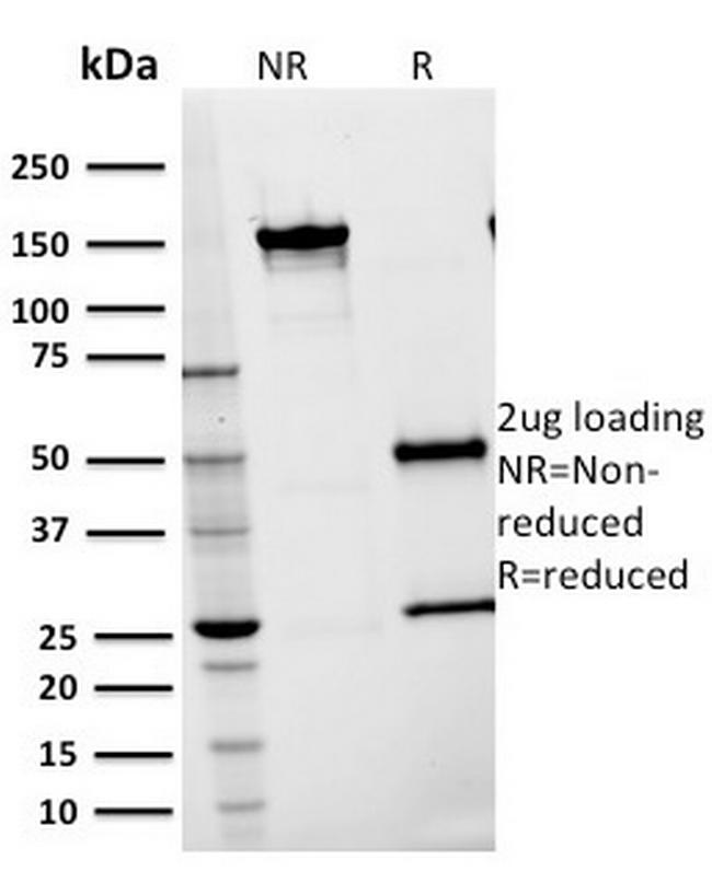 CD54/ICAM-1 Antibody in SDS-PAGE (SDS-PAGE)