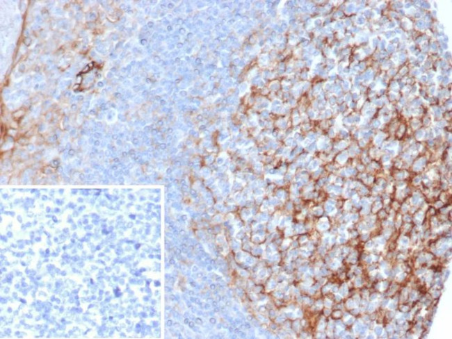 CD54/ICAM-1 Antibody in Immunohistochemistry (Paraffin) (IHC (P))