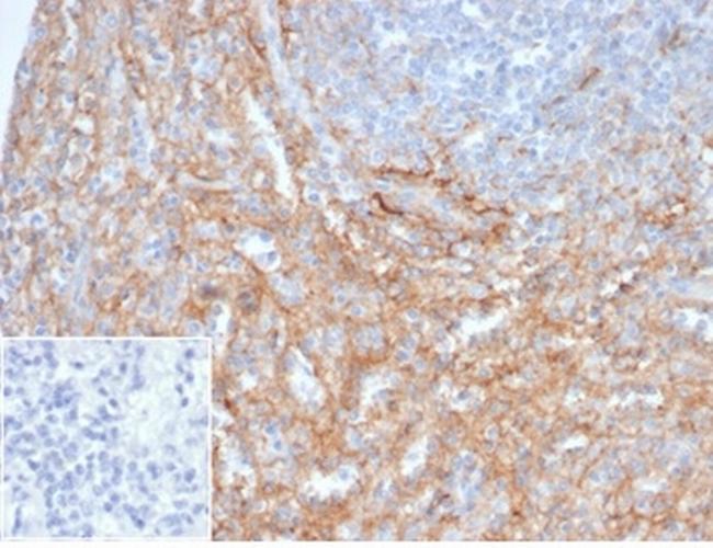 CD54/ICAM-1 Antibody in Immunohistochemistry (Paraffin) (IHC (P))