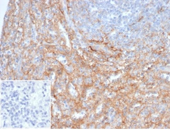 CD54/ICAM-1 Antibody in Immunohistochemistry (Paraffin) (IHC (P))