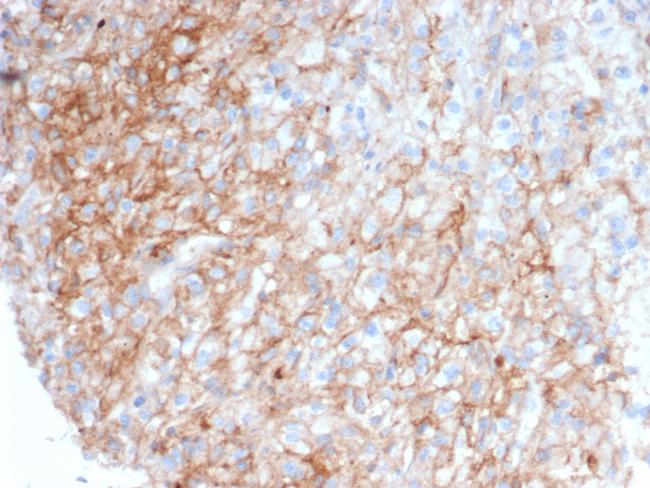 CD54/ICAM-1 Antibody in Immunohistochemistry (Paraffin) (IHC (P))