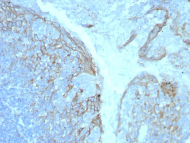 CD54/ICAM-1 Antibody in Immunohistochemistry (Paraffin) (IHC (P))