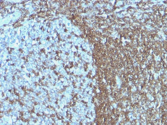 CD50/ICAM3 Antibody in Immunohistochemistry (Paraffin) (IHC (P))