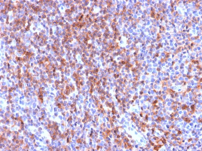 CD50/ICAM3 Antibody in Immunohistochemistry (Paraffin) (IHC (P))