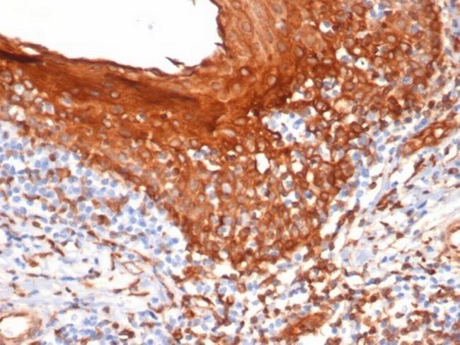 STING1/TMEM173 Antibody in Immunohistochemistry (Paraffin) (IHC (P))