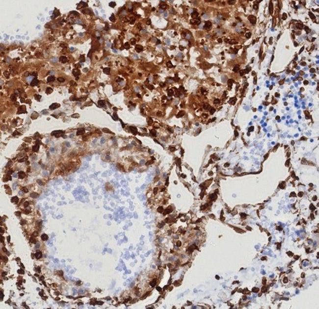 STING1/TMEM173 Antibody in Immunohistochemistry (Paraffin) (IHC (P))