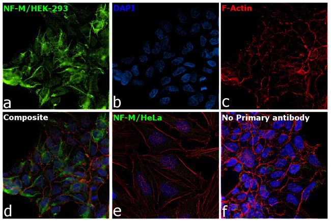 NEFM Antibody in Immunocytochemistry (ICC/IF)