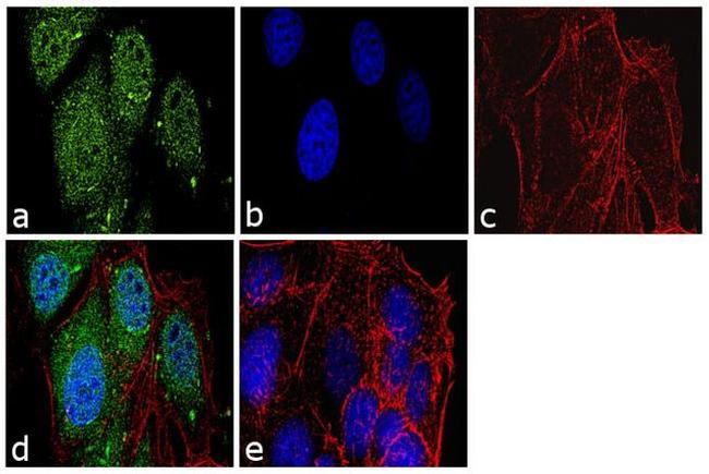 Securin Antibody in Immunocytochemistry (ICC/IF)