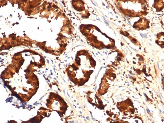 IDH1-R132H (Isocitrate Dehydrogenase) Antibody in Immunohistochemistry (Paraffin) (IHC (P))