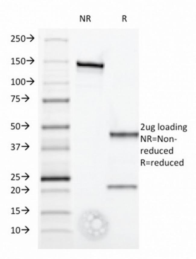 Interferon alpha-1 (IFNA1) Antibody in SDS-PAGE (SDS-PAGE)