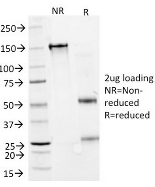 Interferon alpha-2 (IFNA2) Antibody in SDS-PAGE (SDS-PAGE)