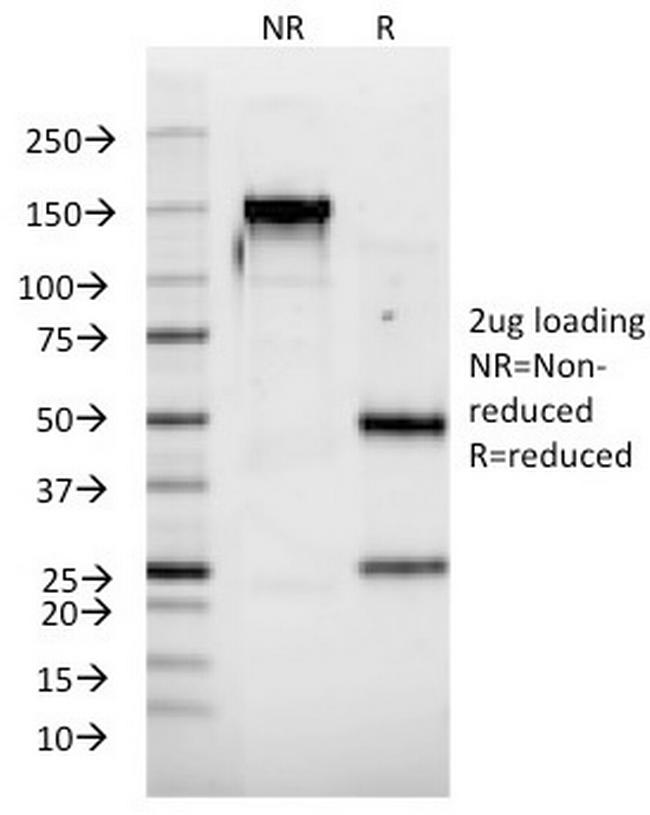 Interferon alpha-2 (IFNA2) Antibody in SDS-PAGE (SDS-PAGE)