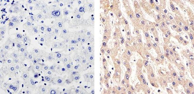 CD146 Antibody in Immunohistochemistry (Paraffin) (IHC (P))